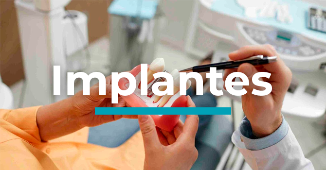 IMPLANTES