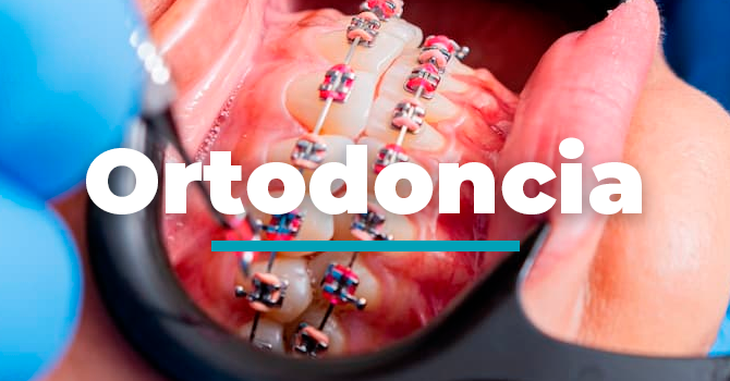 ORTODONCIA