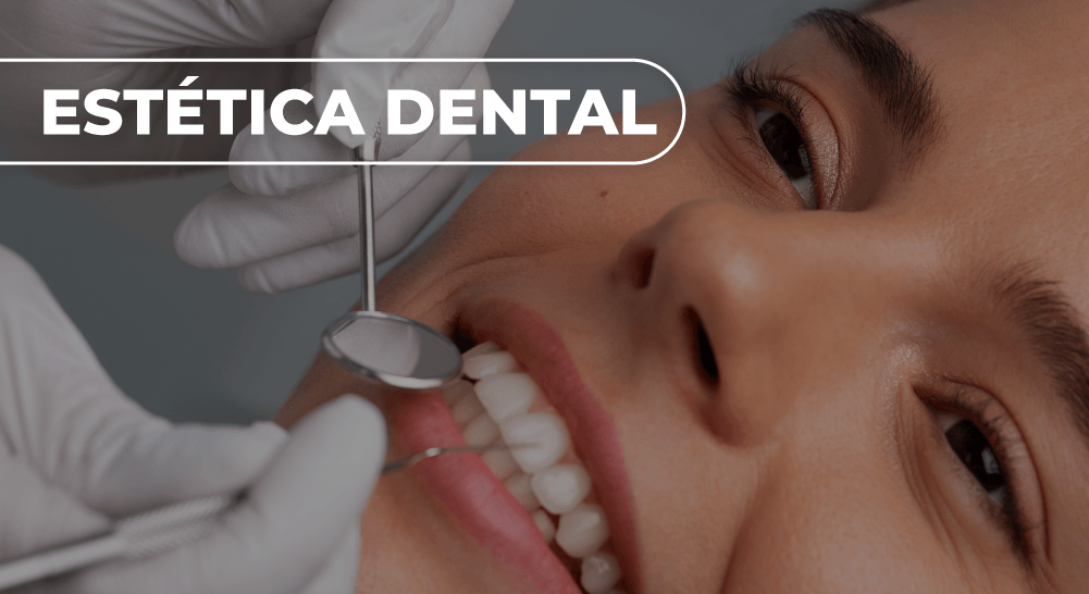 ESTÉTICA DENTAL