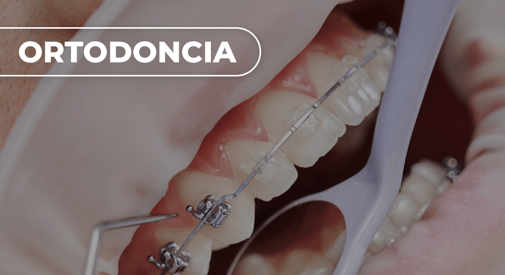 ORTODONCIA